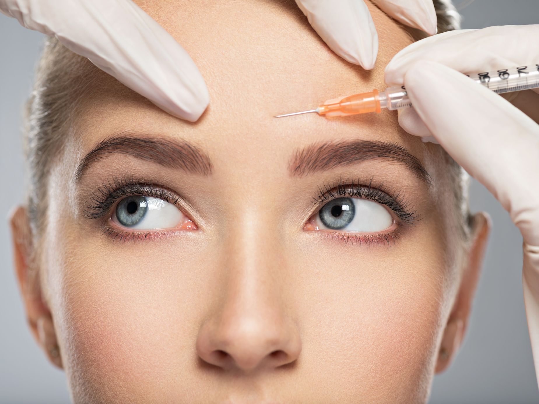 Как избавиться от постакне? estmed.by
