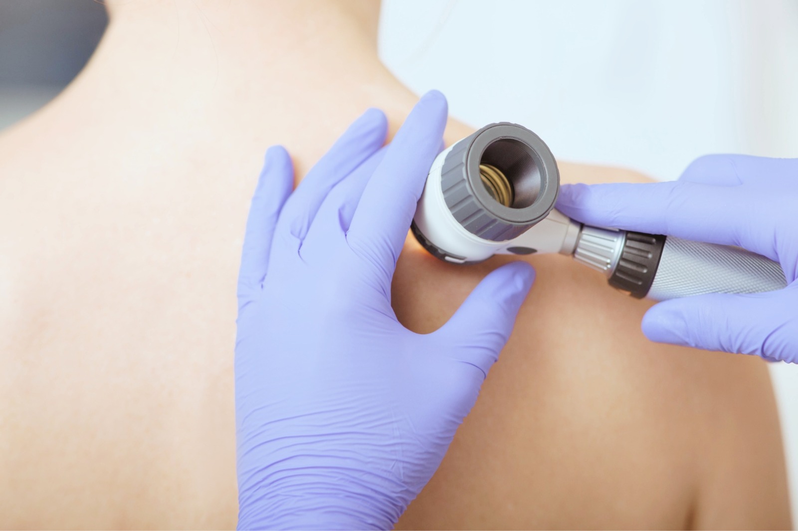 Дерматоскопия: что это, как проводится и что показывает? estmed.by