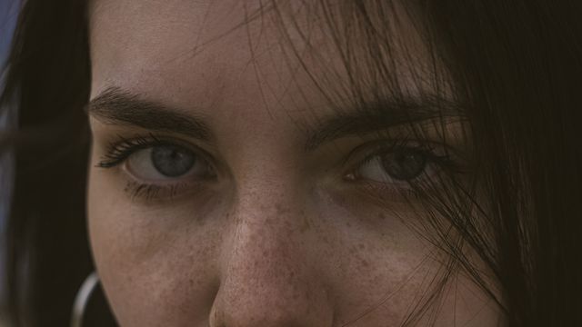 Темные круги под глазами: причины и способы коррекции estmed.by